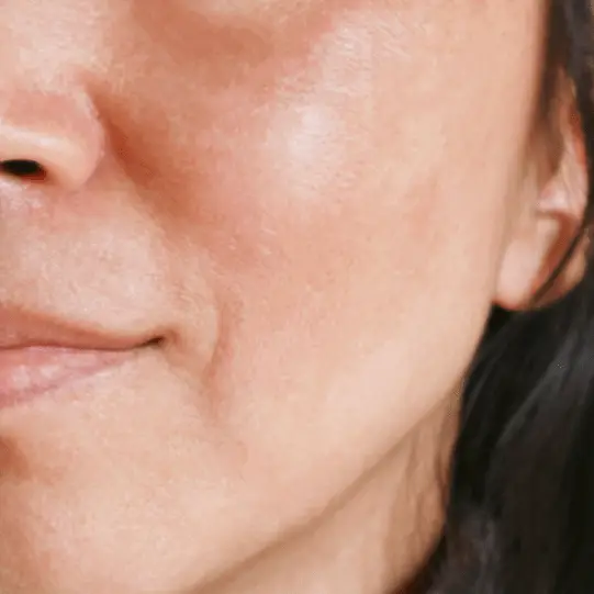 Chemical Peel After Care Access Clinic