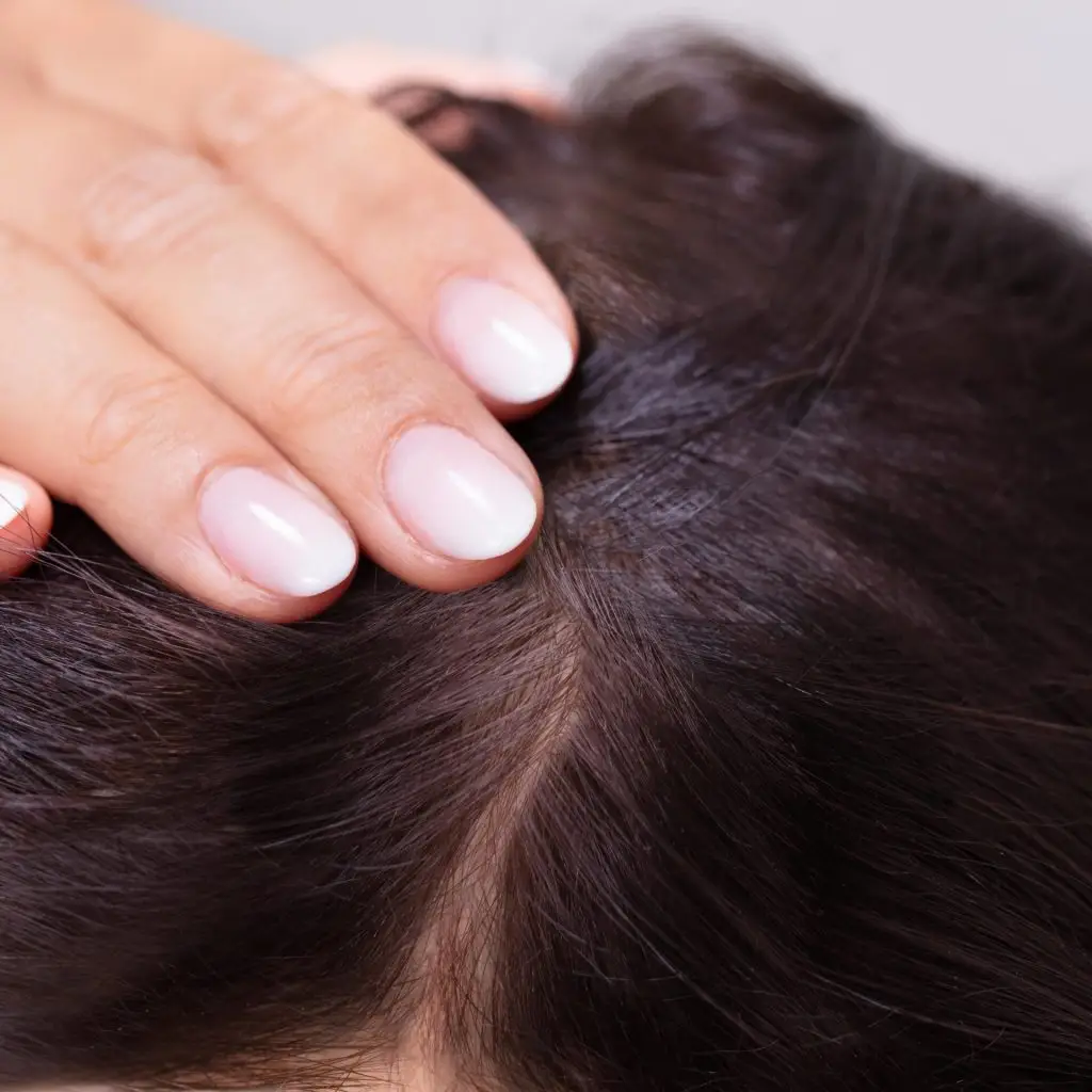 PRP Hair Restoration After Care Access Clinic