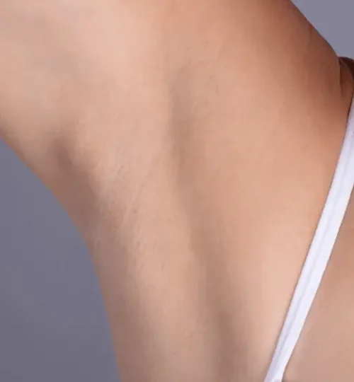 Laser Hair Removal After Care Access Clinic